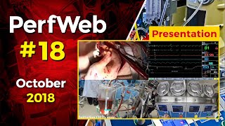Pump and Operative Field Shown Simultaneously - Mark Mettauer MD