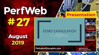 ECMO cannulation. Extracorporeal Membrane Oxygenation - Dr. Hany Samir